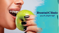 غذاهای ممنوع در ارتودنسی