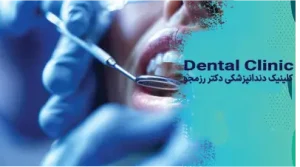 اصلاح لبخند لثه‌ای