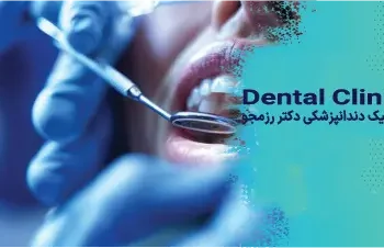 اصلاح لبخند لثه‌ای