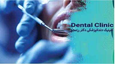 اصلاح لبخند لثه‌ای