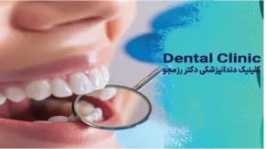 ایمپلنت در یک روز