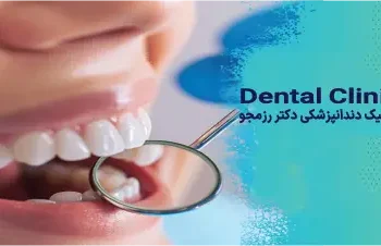 ایمپلنت در یک روز