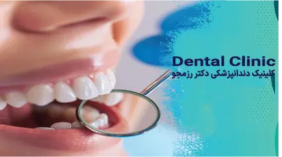 ایمپلنت در یک روز