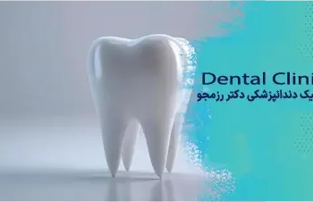 ایمپلنت دندان جلو