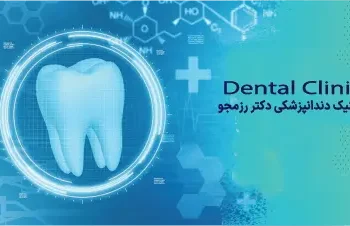 ایمپلنت فوری