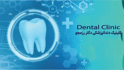 ایمپلنت فوری