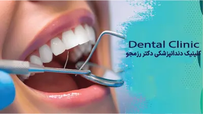 ایمپلنت فک پایین