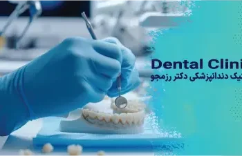 ترمیم کامپوزیت شکسته