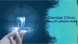 زمان ایمپلنت قدامی