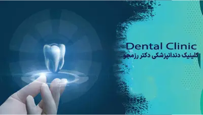 زمان ایمپلنت قدامی