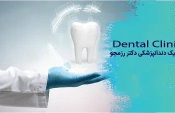 زیبایی ایمپلنت قدامی