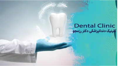 زیبایی ایمپلنت قدامی