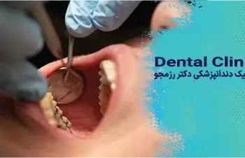ضرورت دهان‌شویه