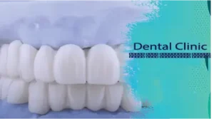 لمینت طبیعی یا هالیوودی