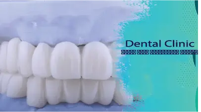 لمینت طبیعی یا هالیوودی