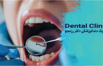 مقایسه ایمپلنت کامل وپروتز