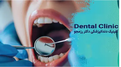 مقایسه ایمپلنت کامل وپروتز