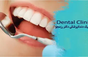 پروتز ثابت برپایه ایمپلنت