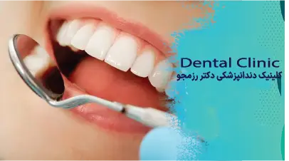 پروتز ثابت برپایه ایمپلنت