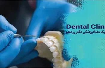 کامپوزیت بدون تراش دندان